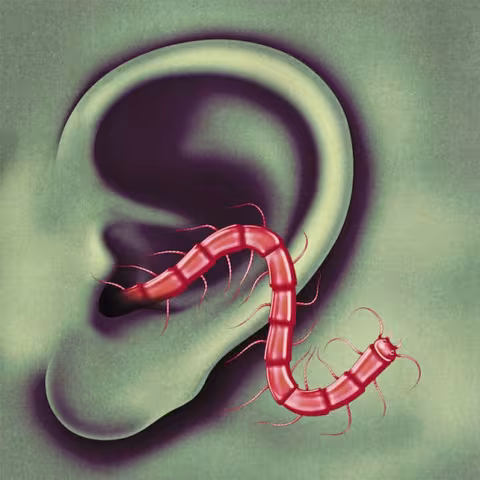 theeohsees-cover.jpg